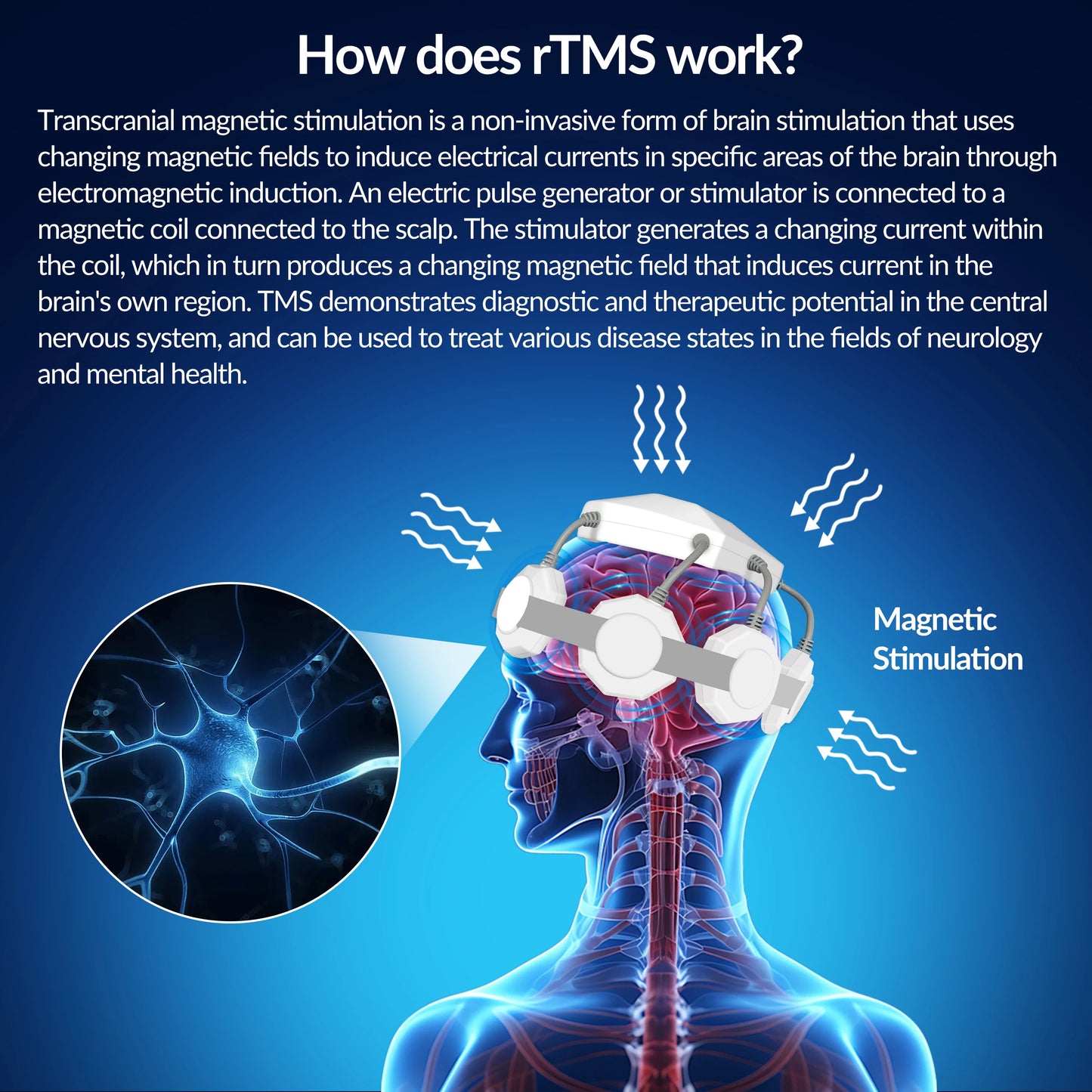 ZJKC Transcranial Magnetic Stimulation Device For Depression Parkinsons Insomnia